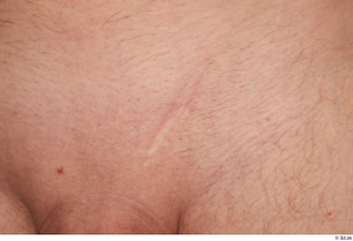 Stanley Johnson nude scar skin 0001.jpg